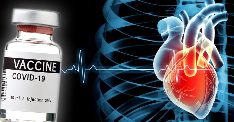 Un studiu susține că COVID a provocat mai multe leziuni cardiace decât vaccinurile – Iată ce au greșit autorii